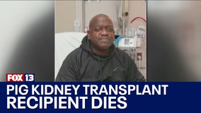 1st pig kidney transplant recipient dies